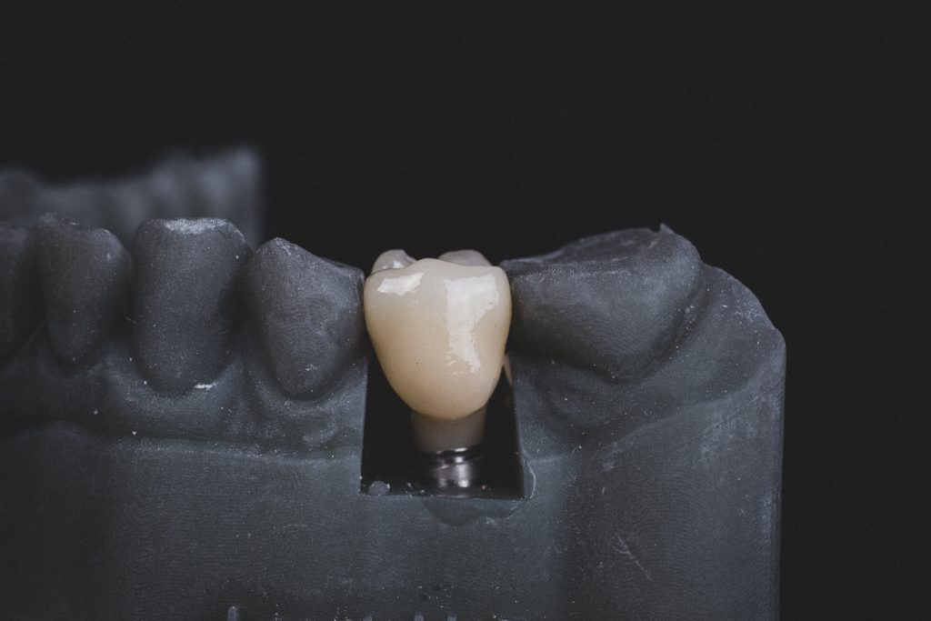 Dental Implant Lab