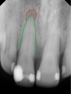 What Is An FMX? | Rich Dawson DMD