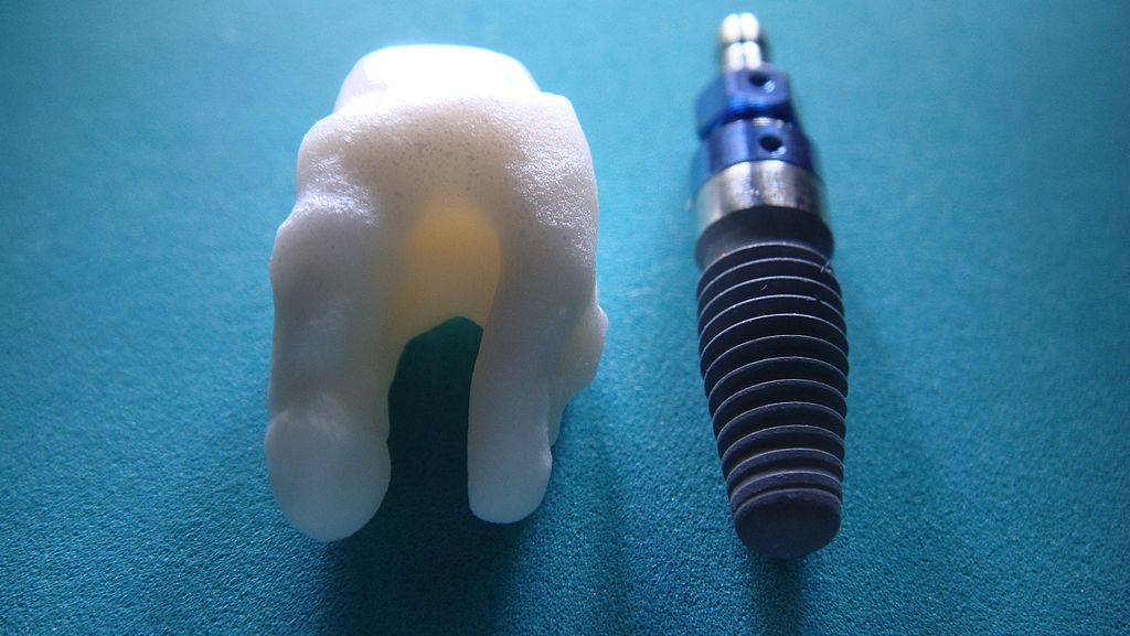 Ceramic Implant Anologue Ceramic Implant Anologue