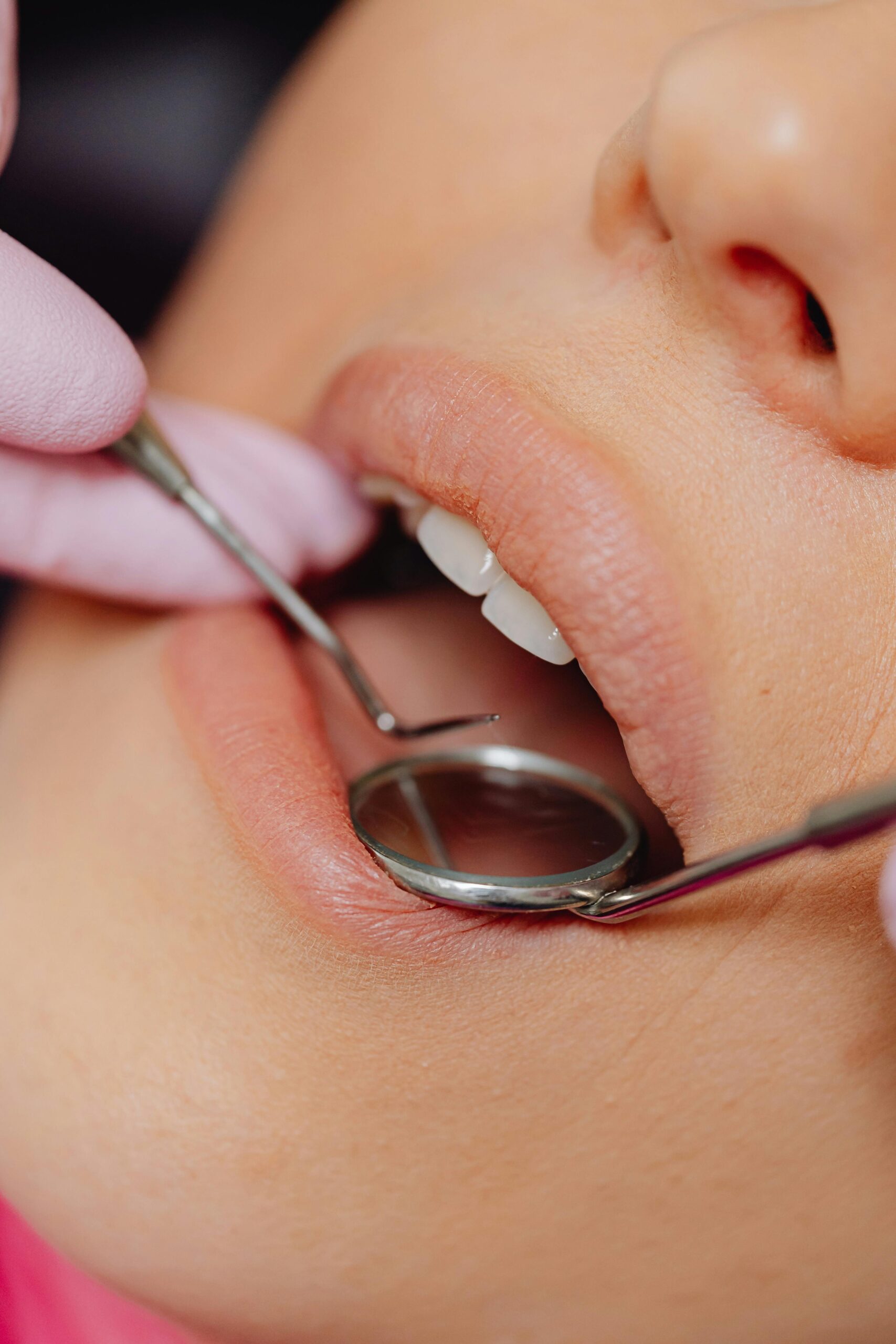 Close-up of a dental examination with a mirror and probe.