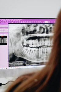 Dental X-ray displayed on a computer screen.
