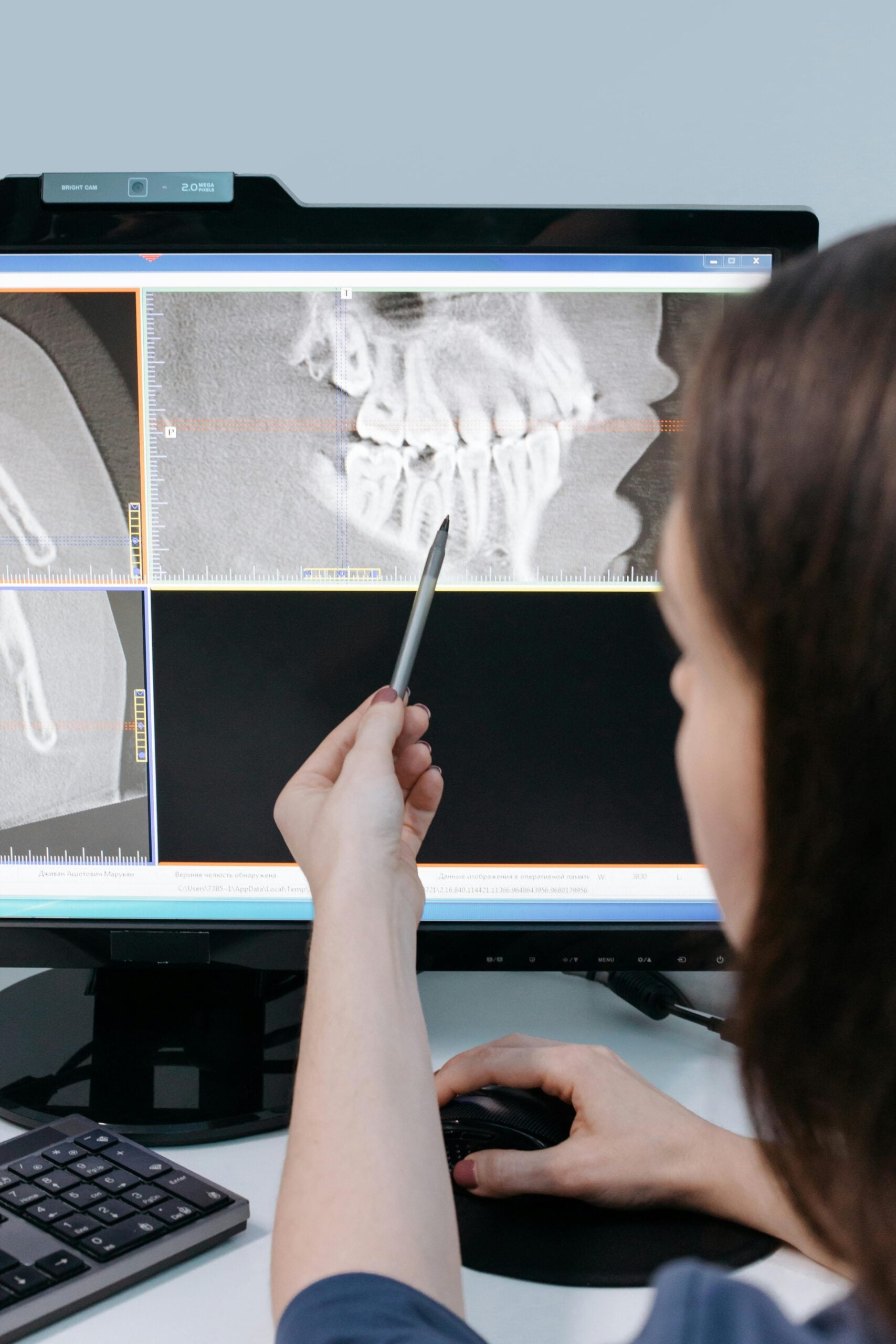 Person pointing at dental X-ray on computer screen.