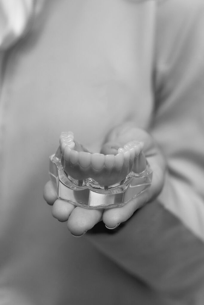 Dental model held in a hand, illustrating adhesive vs traditional cementation.