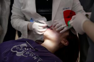 Dentist using Tofflemire matrix on a patient during a procedure.